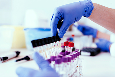 Diabetes lab