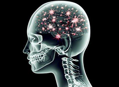 Epilepsy