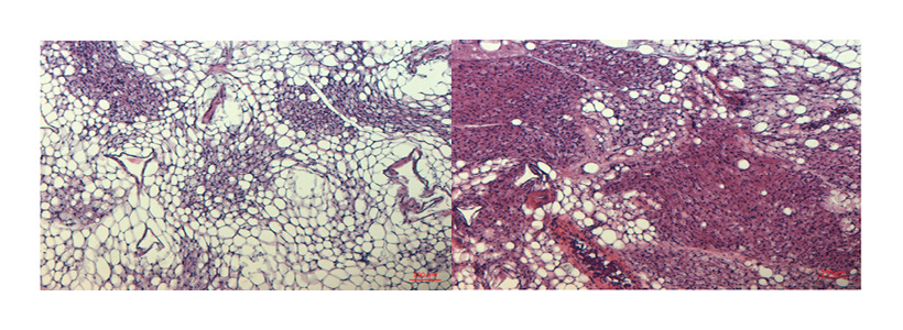 Fat cells