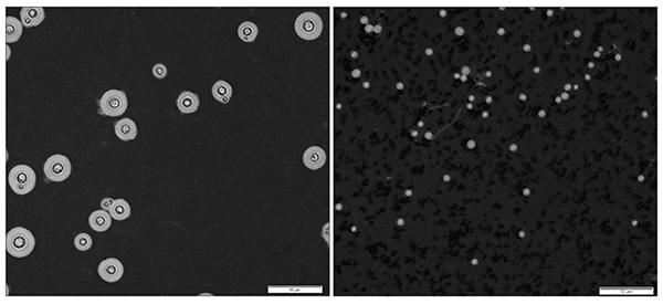 Two sizes of the pathogenic fungus Cryptococcus neoformans.