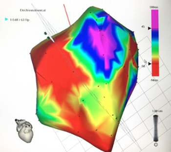 3D heart imageing