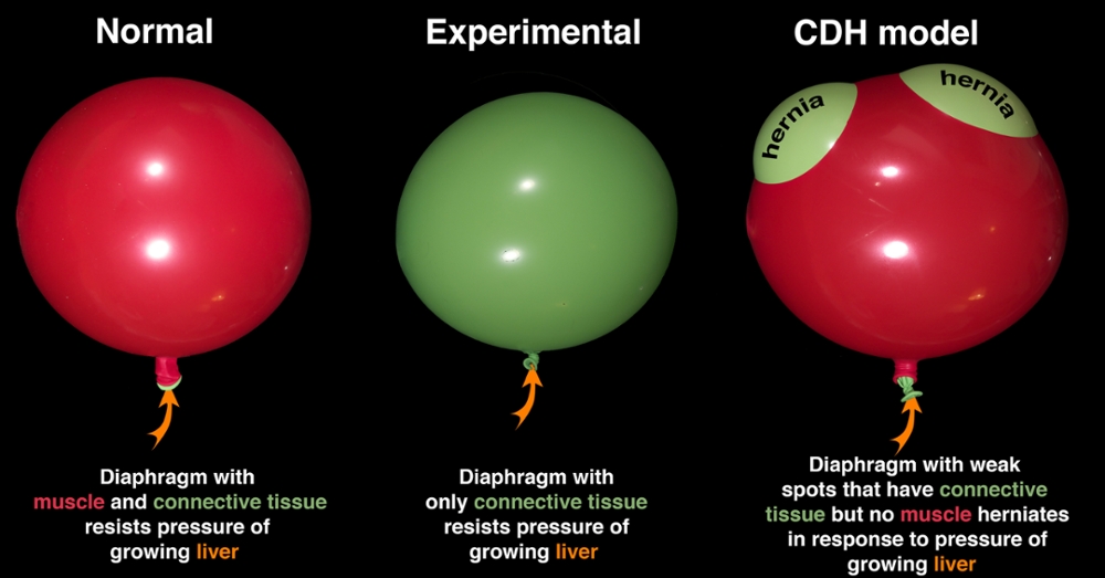 CDH model