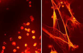 anti-inflammatory factor