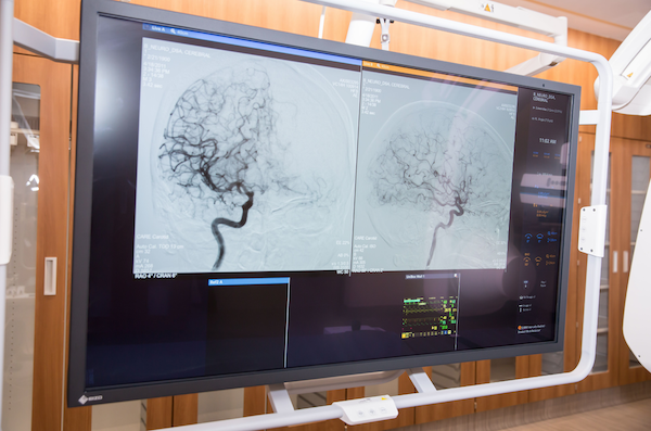Radiology Area Scan