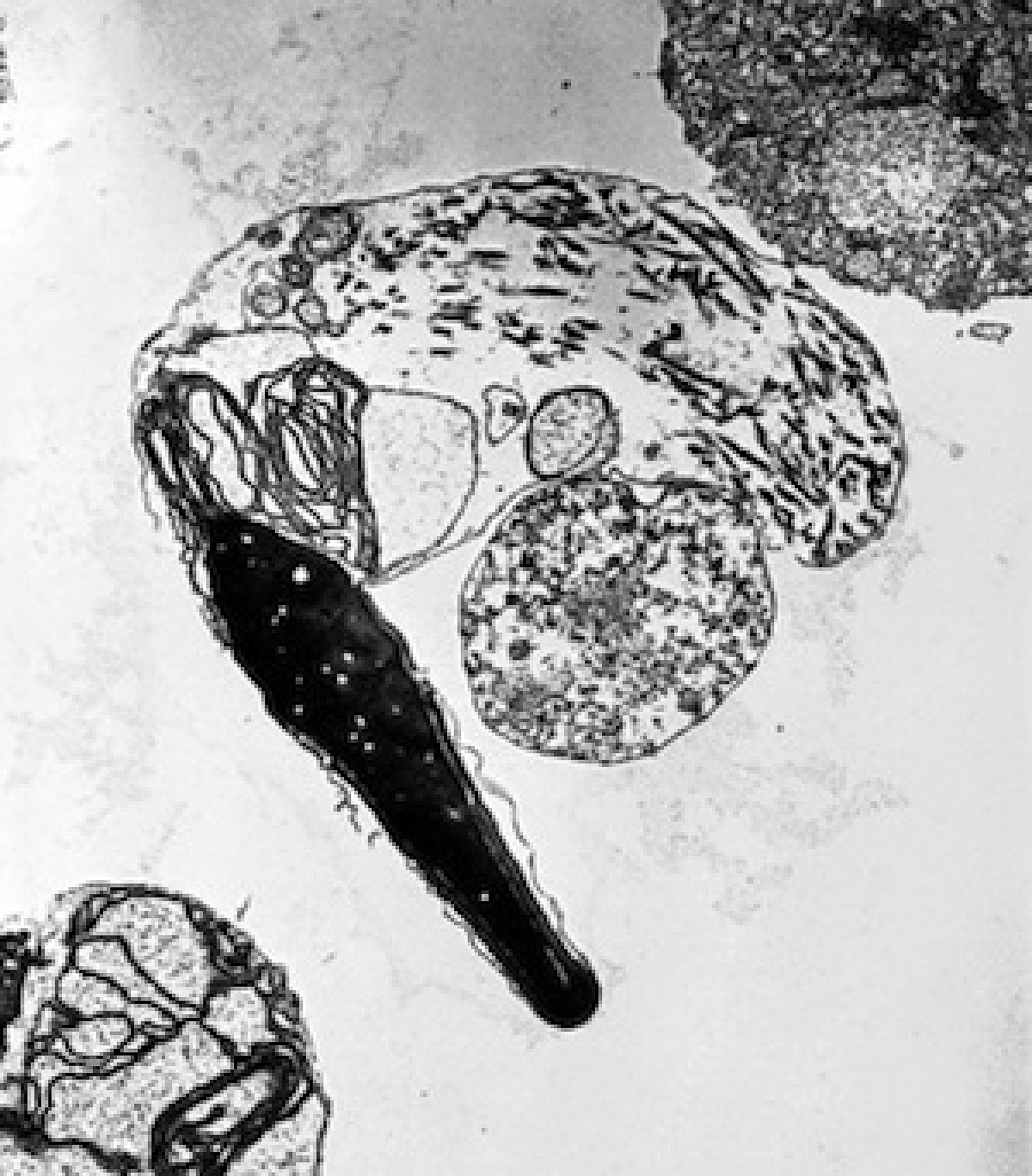 Microscope photograph of abnormal sperm