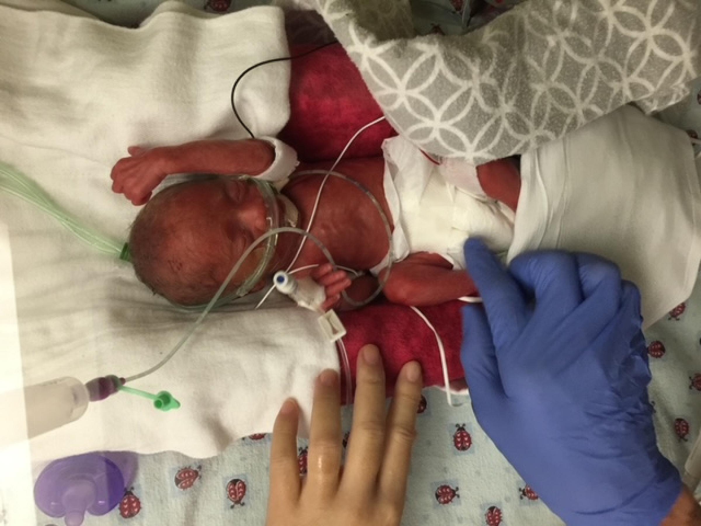 Chloe Jane Cook, NICU patient at U of U Health