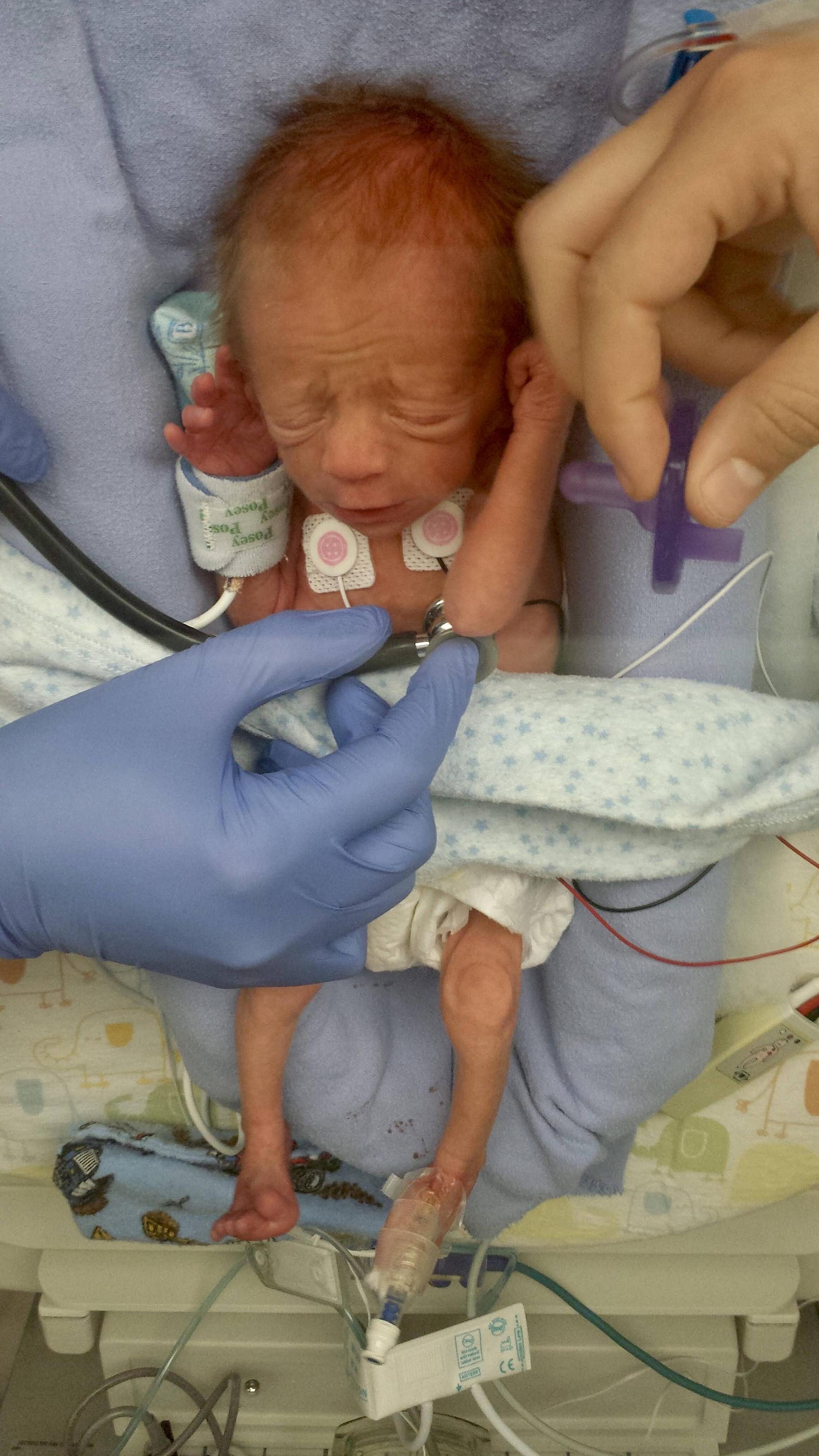 Sebastian Barton in the NICU