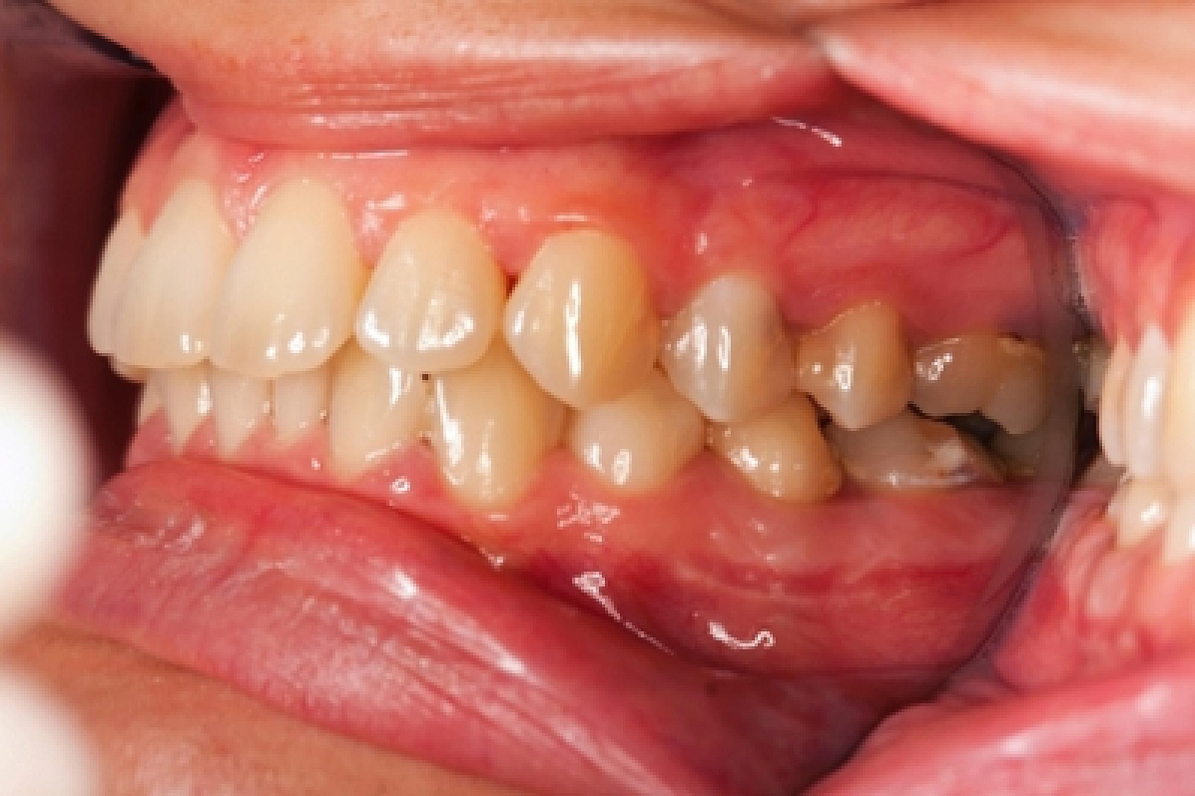 Teeth