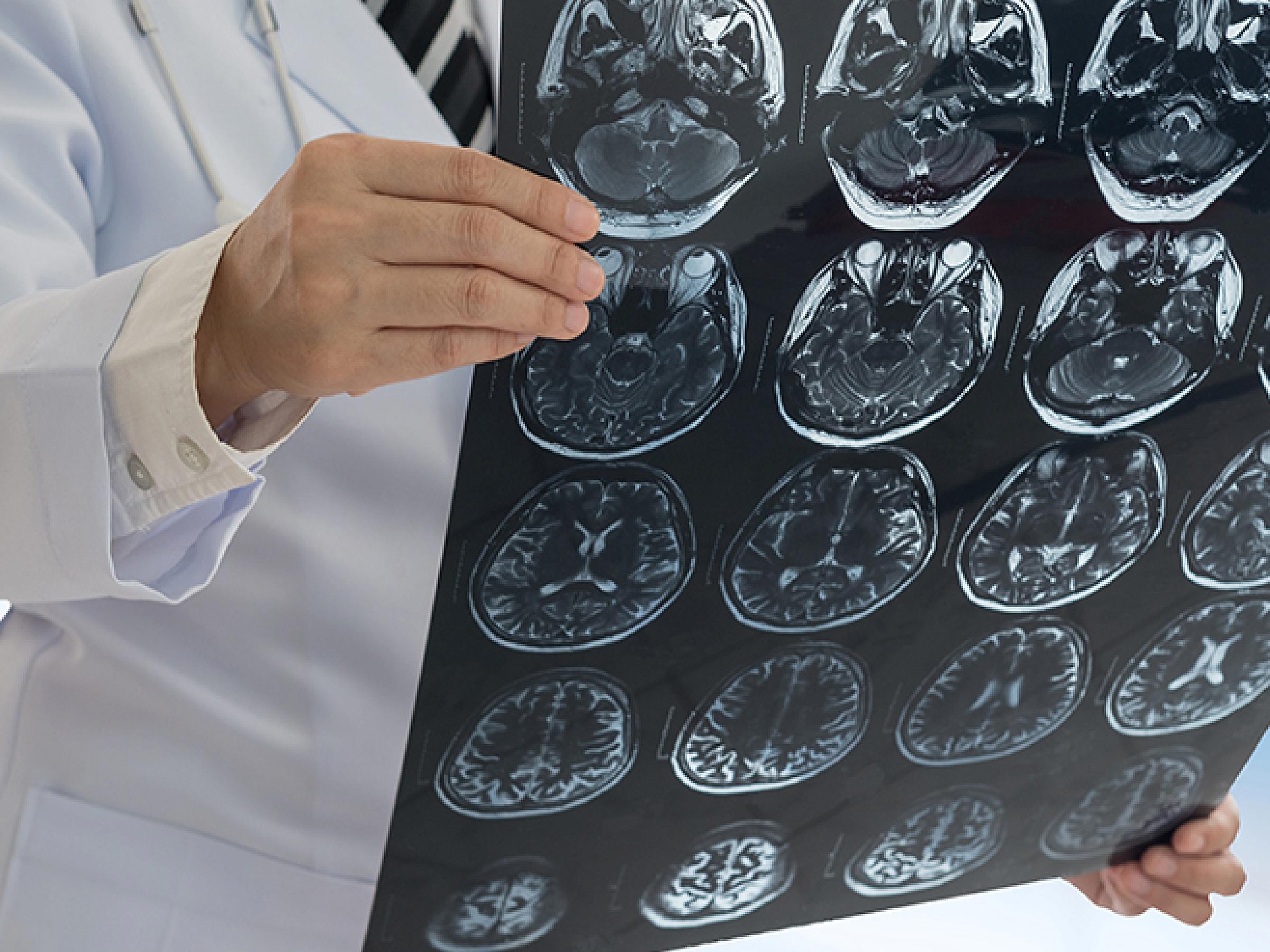 Doctor in white coat holds up brain X-ray scans