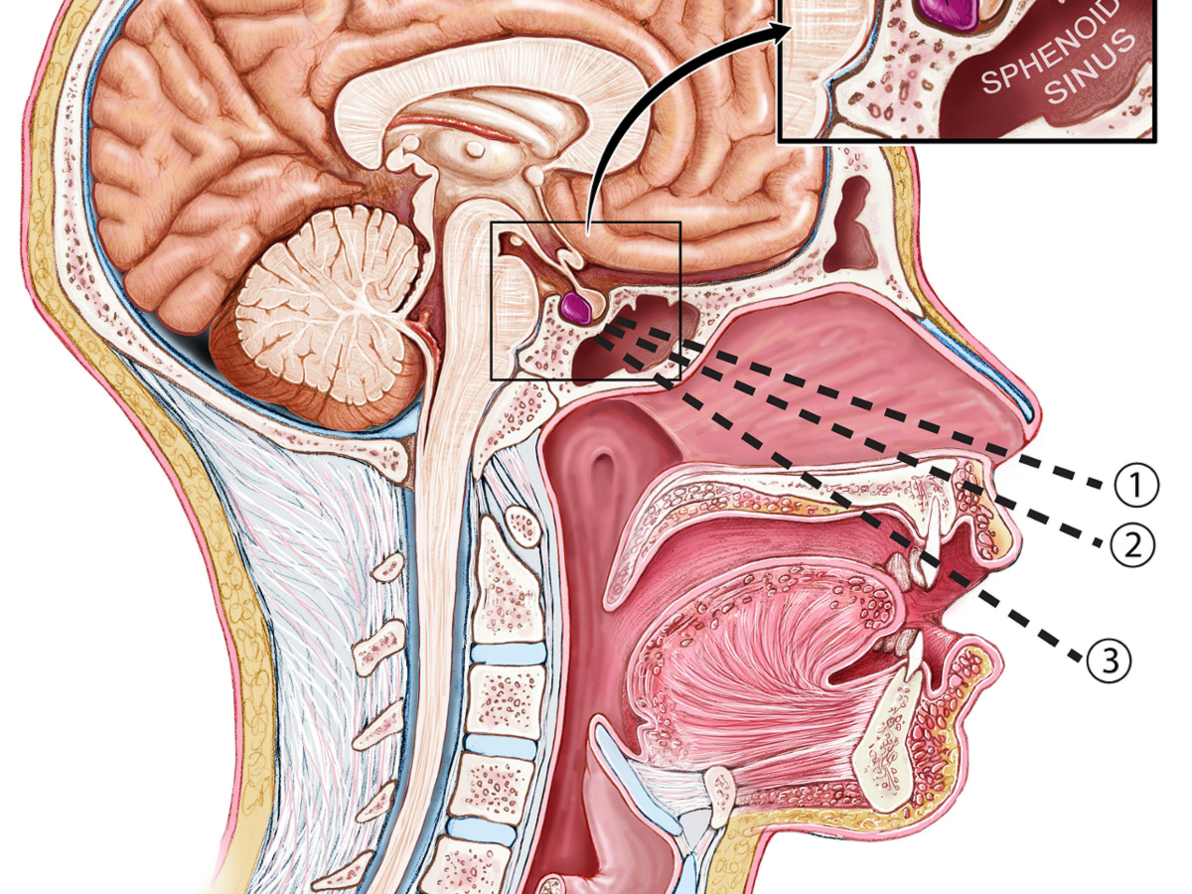 Medical illustration of a the brain and location of the pituitary tumor