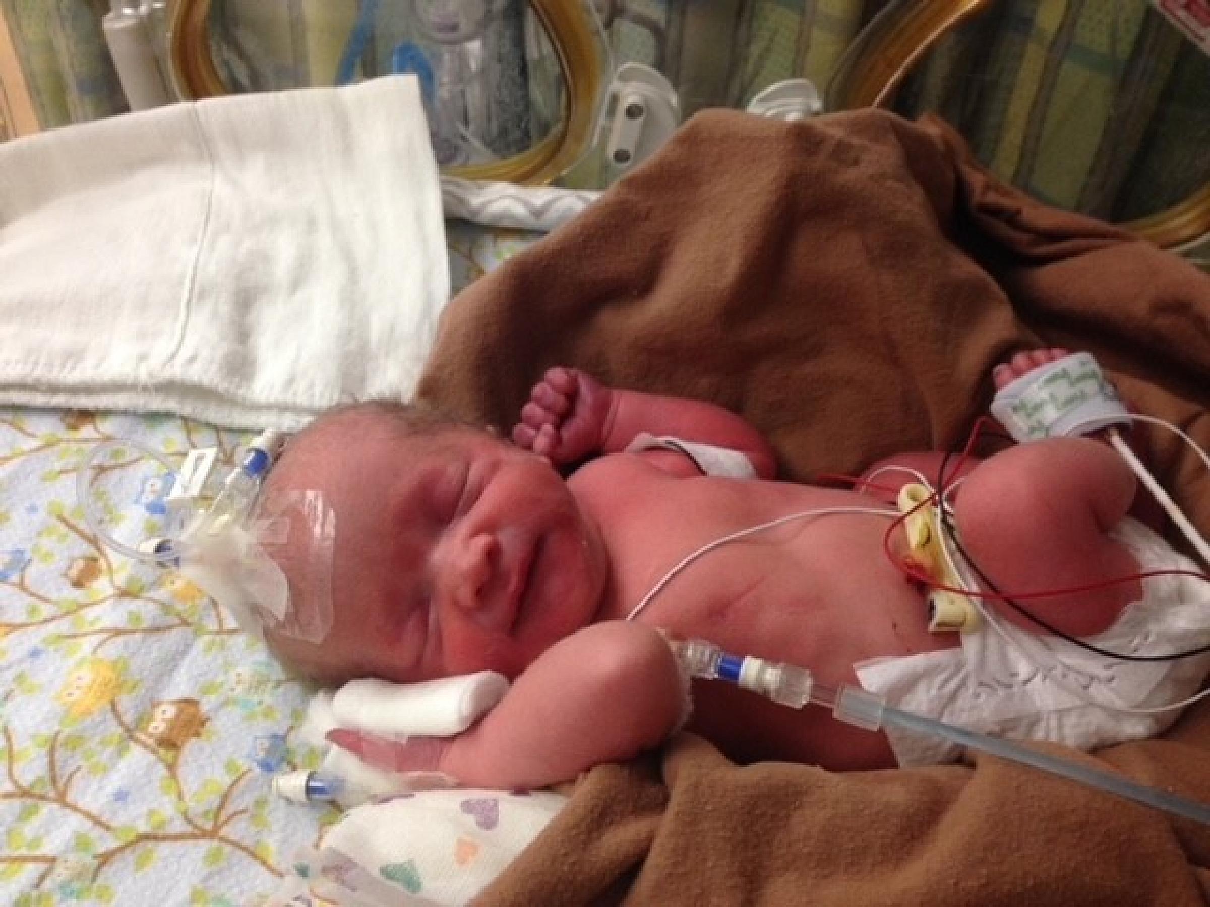 Hank and Wem Blemler, NICU Patients