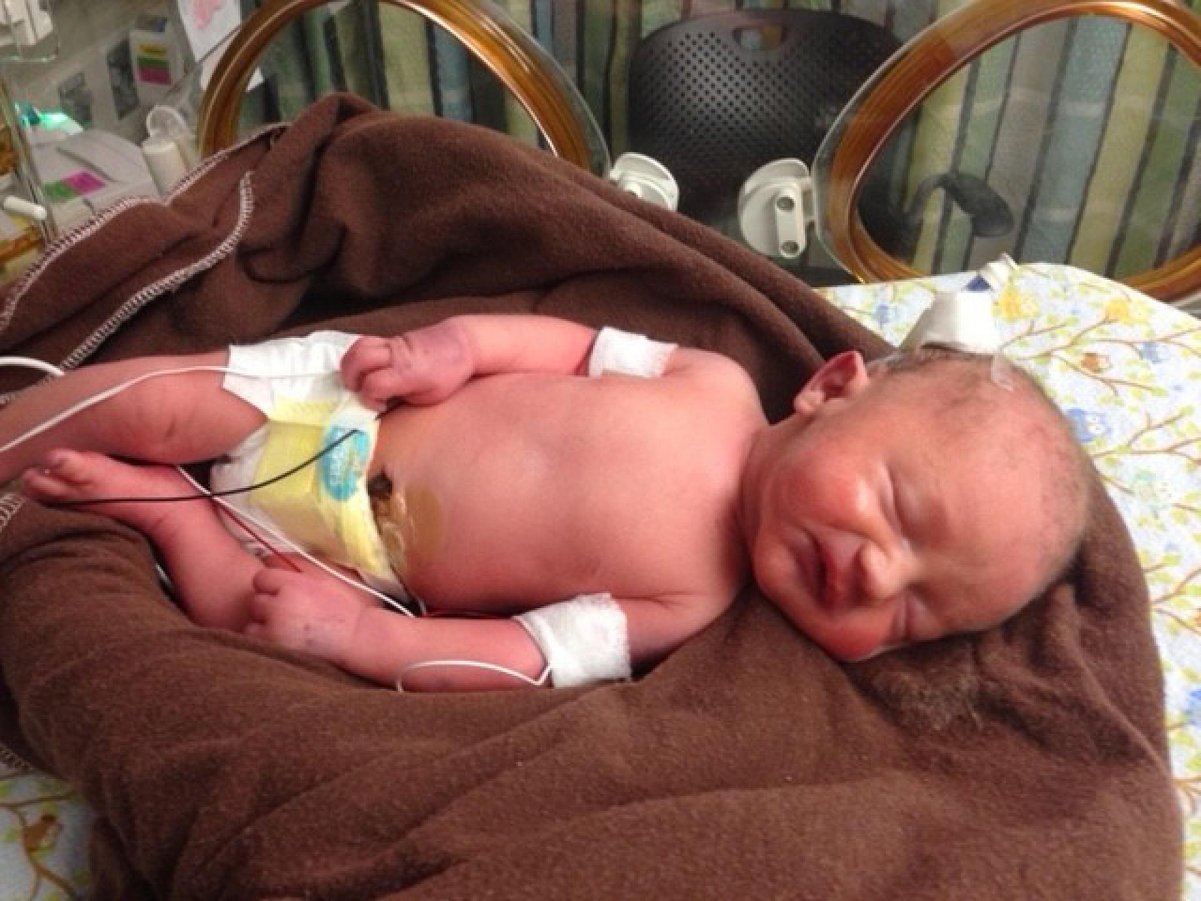 Hank and Wem Blemler, NICU Patients