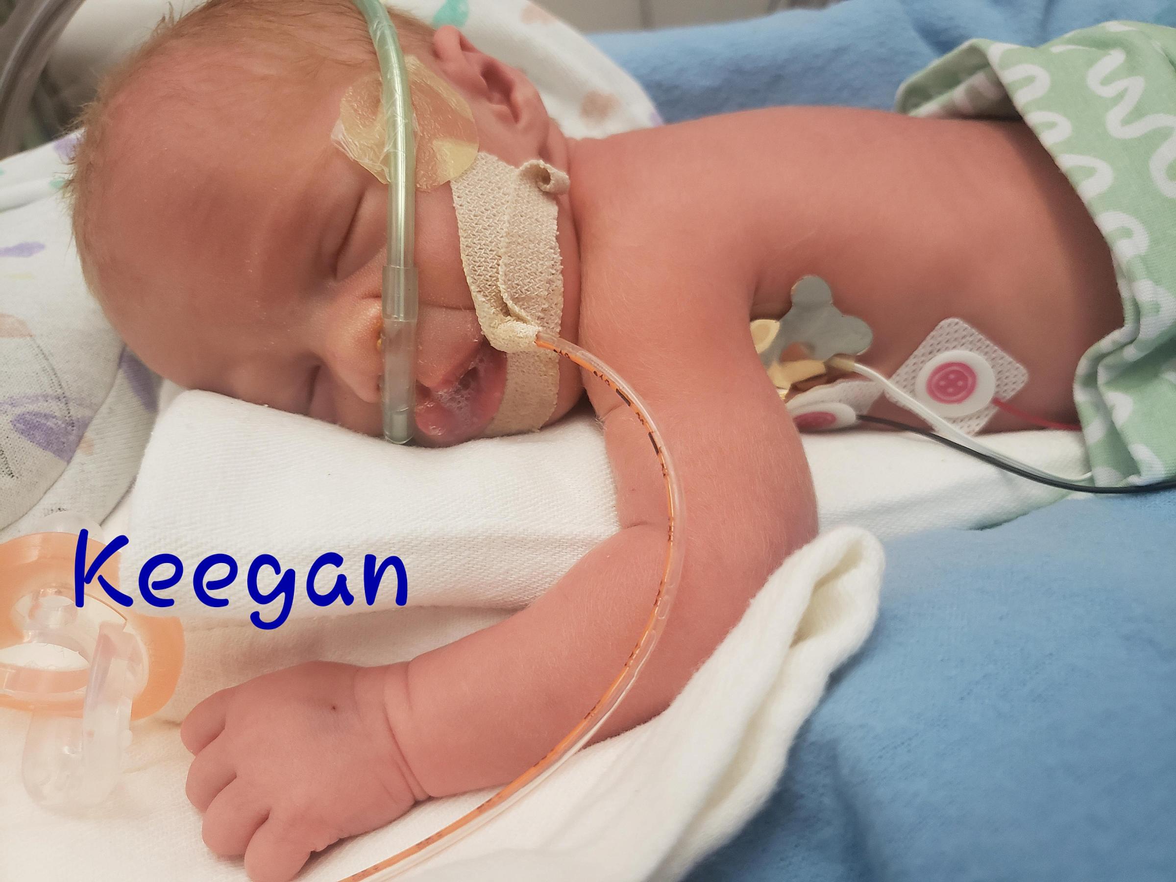 Keegan Thatcher, NICU Patient