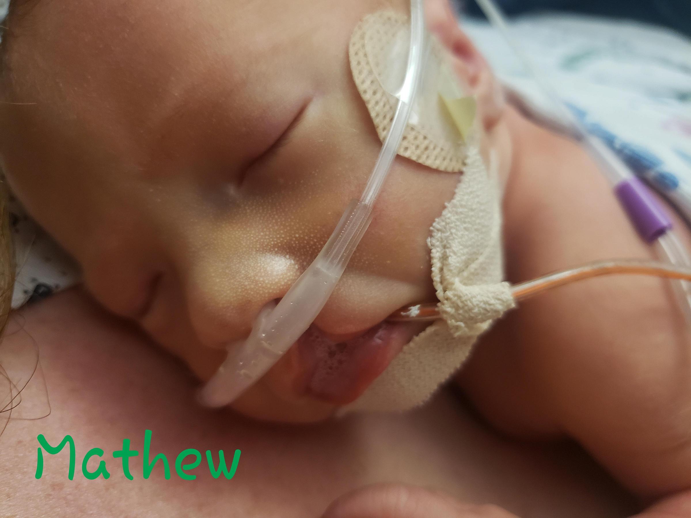 Matthew Thatcher, NICU Patient