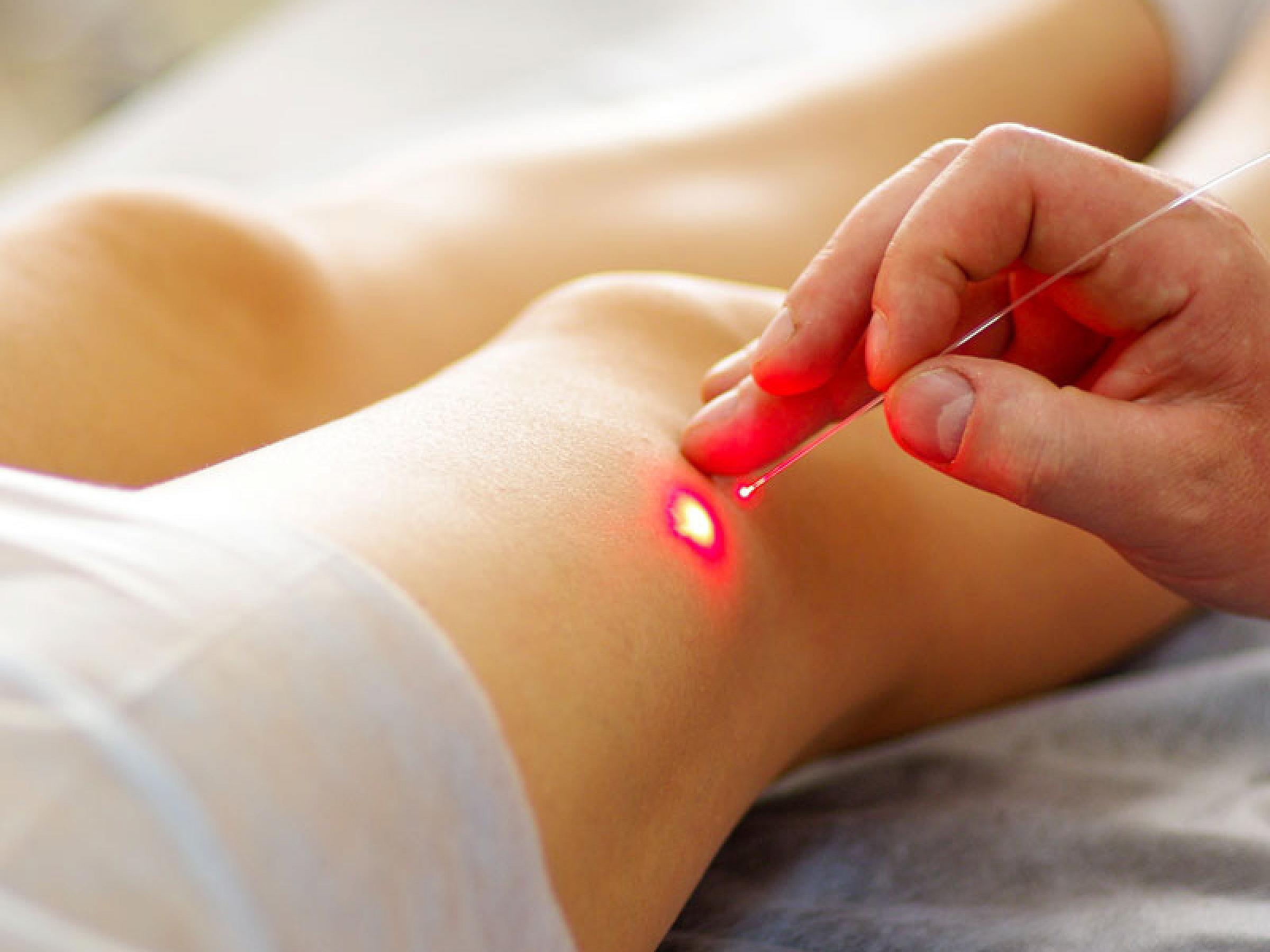 Picture of red laser beam pointing at a person's leg