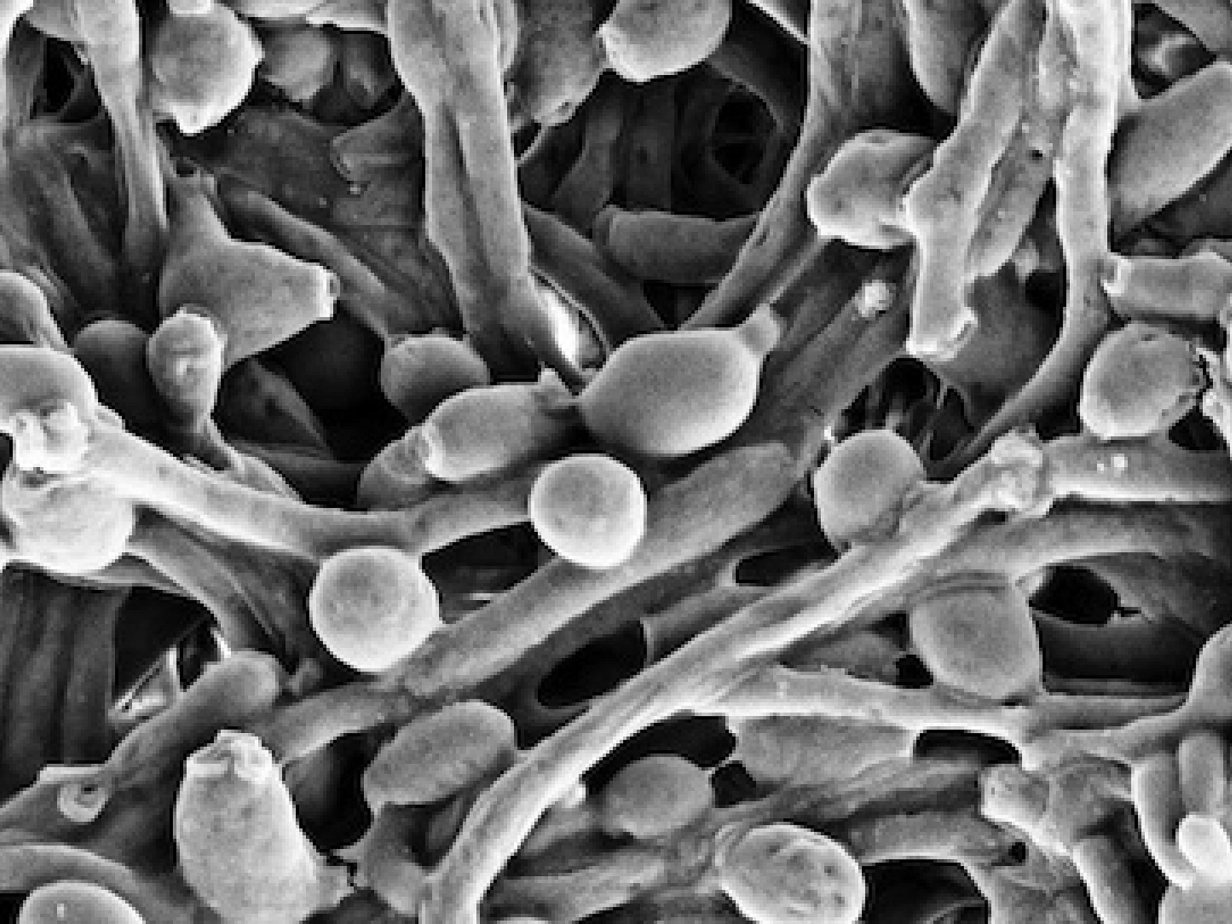 Candida Albicans