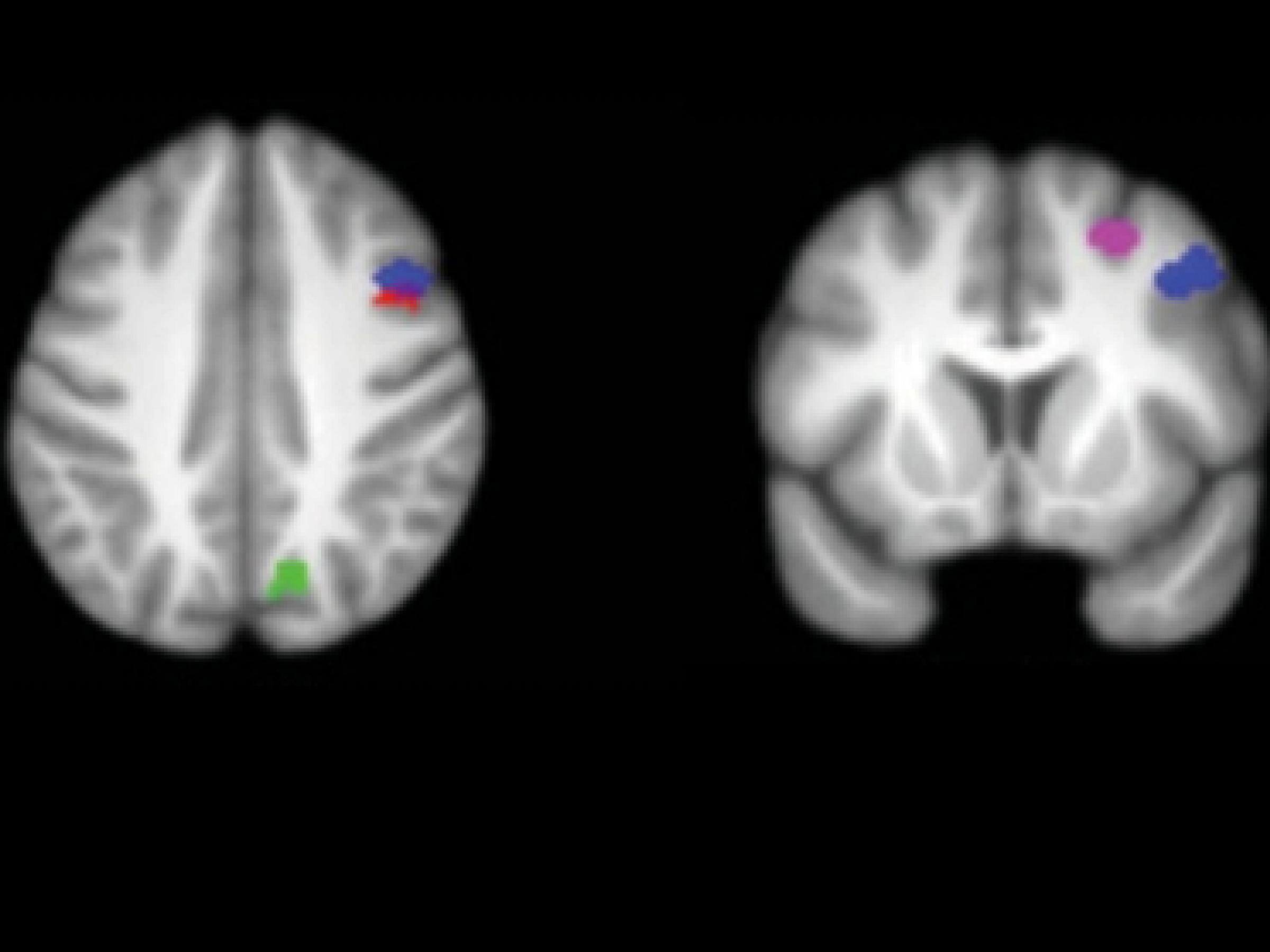 Brain Scan
