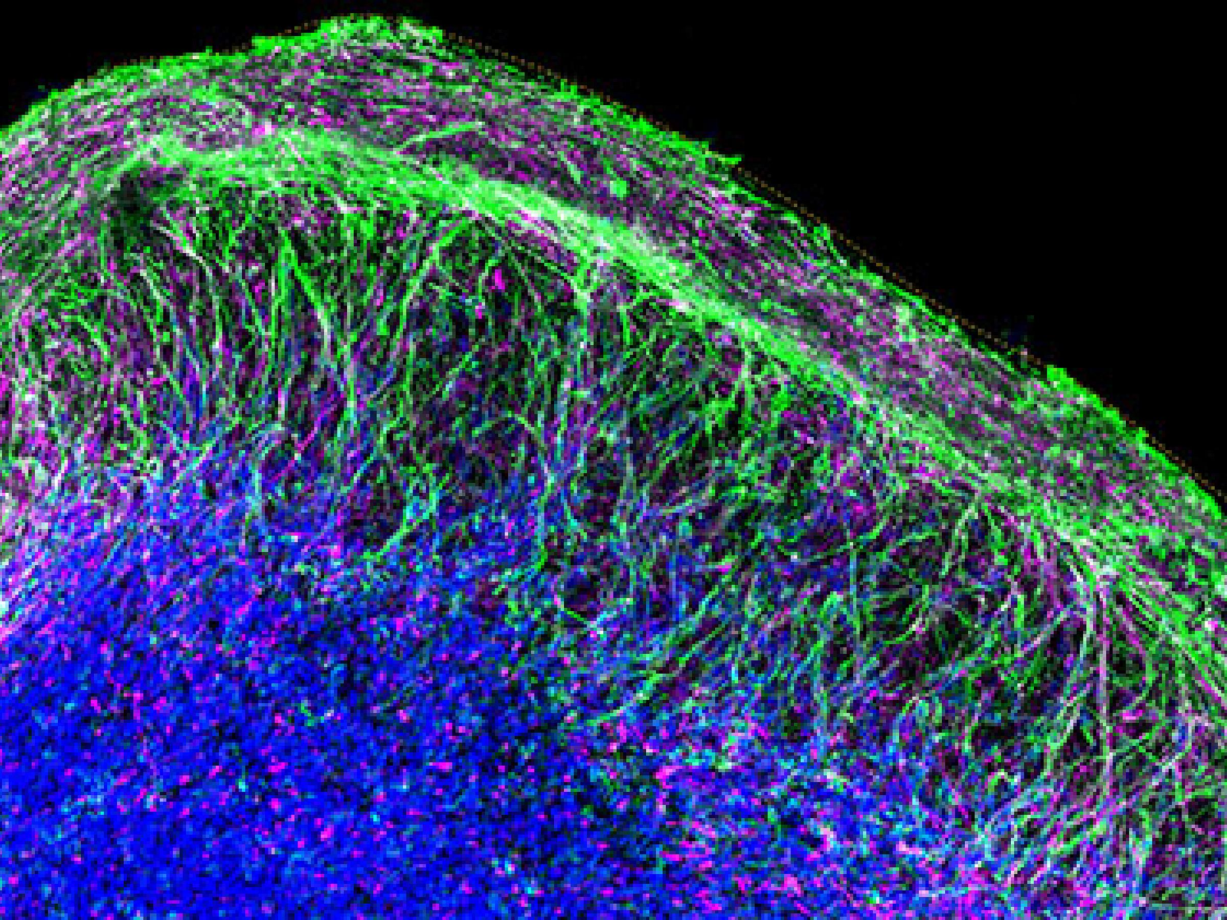 Organoid Slice
