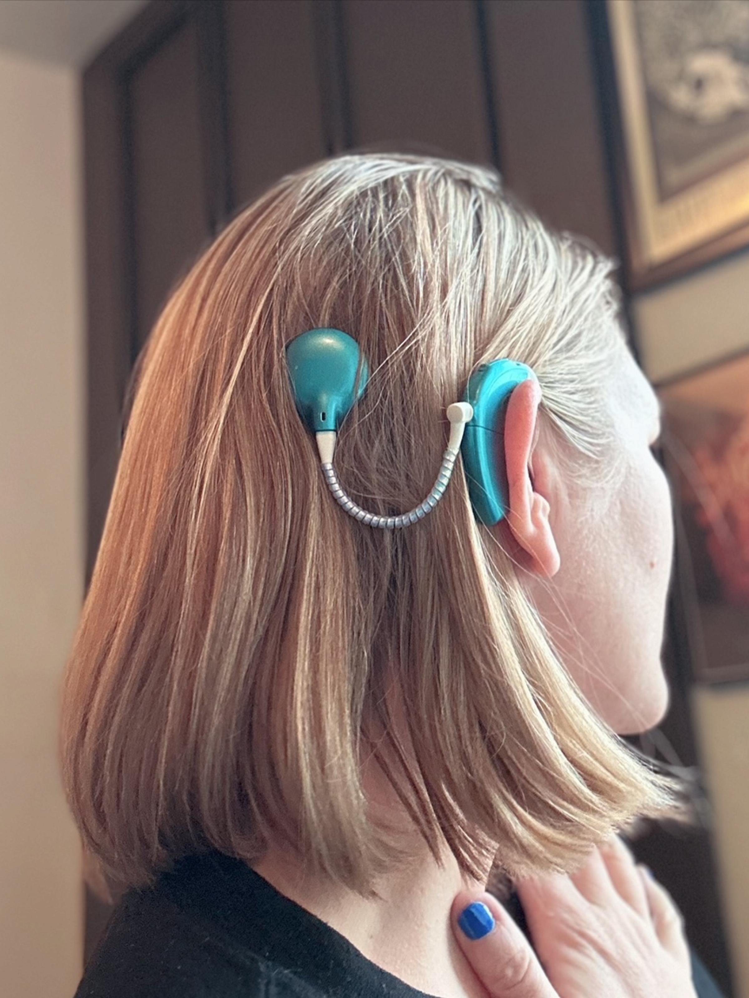mindy's cochlear implant