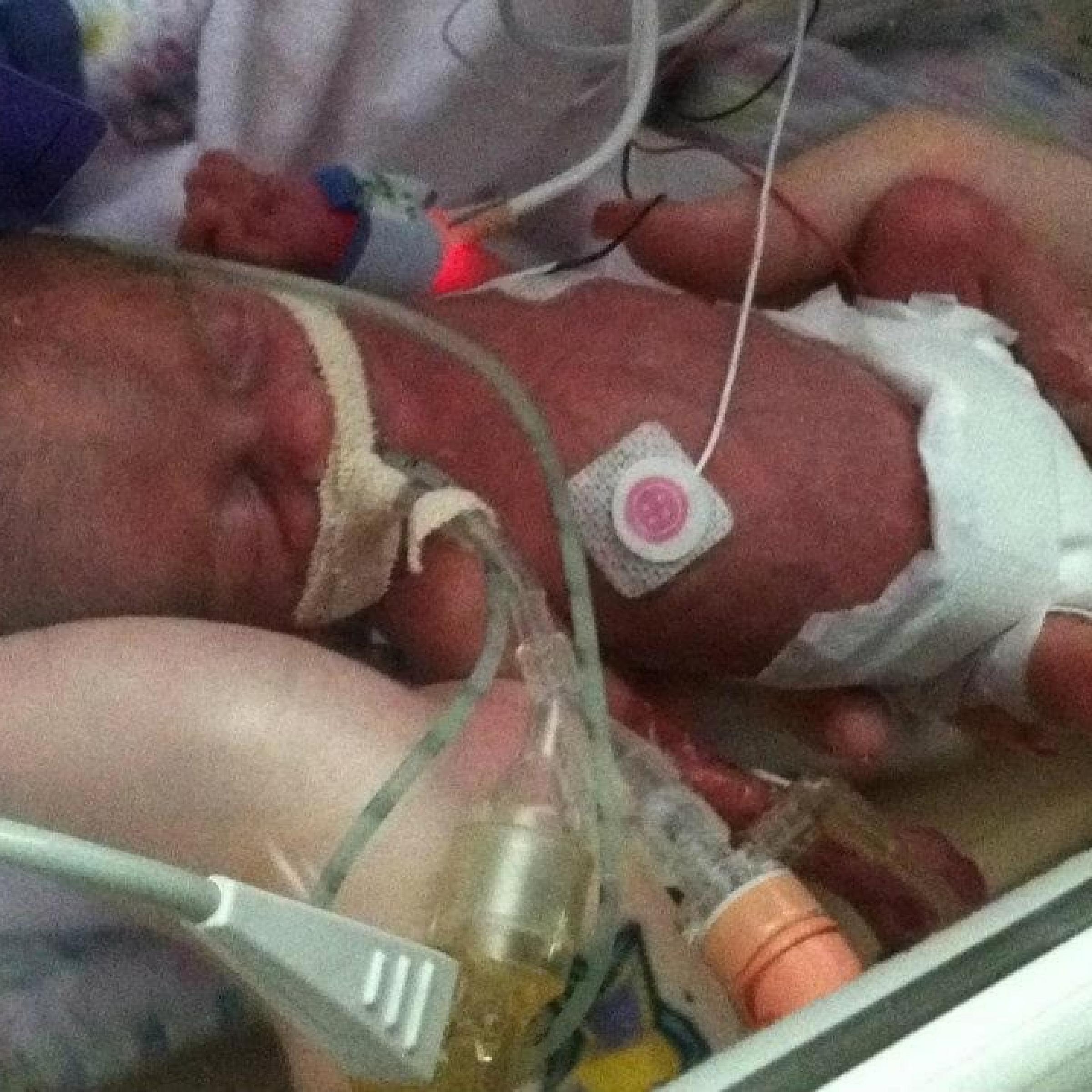 Close up of Bentley in the NICU incubator