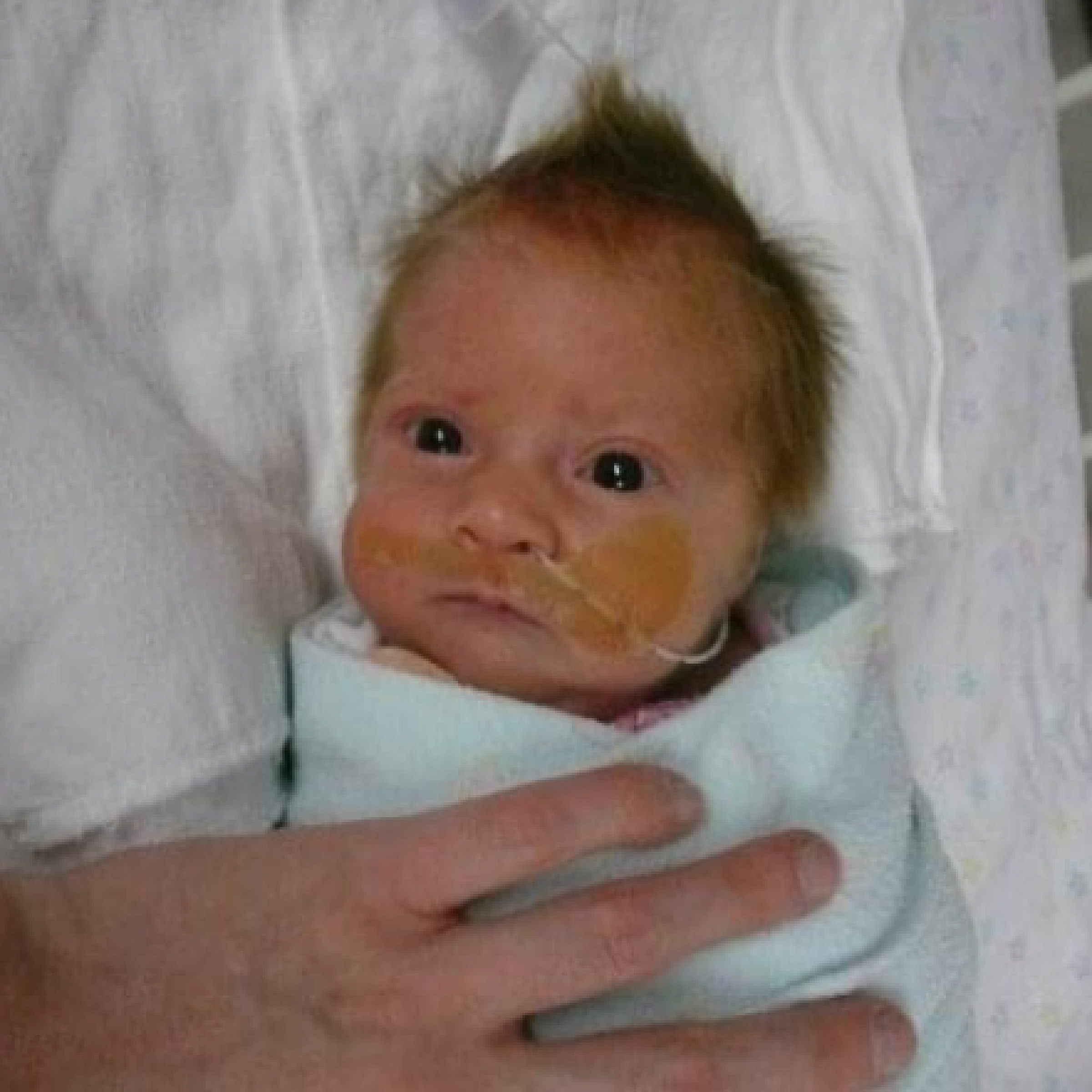 Emily Miller, NICU Patient