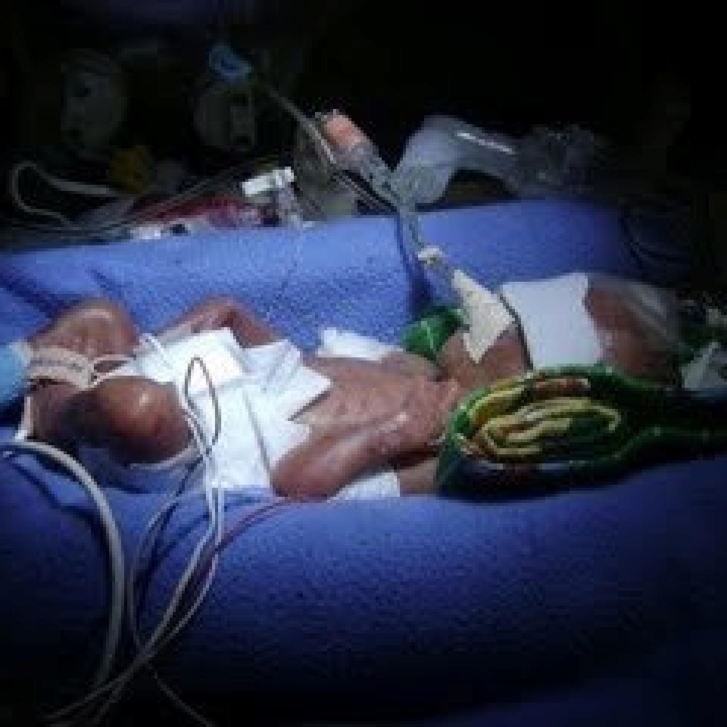 Jaxon, Gavin, and Jacee, NICU patients